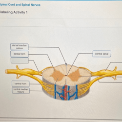 Labeling sectional spinal solved transcribed problem