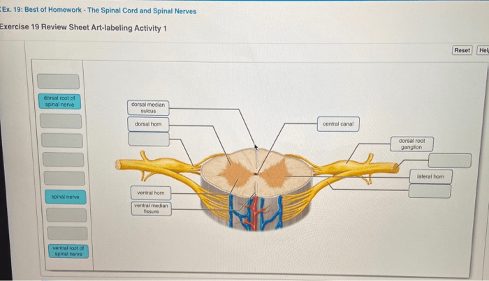 Labeling sectional spinal solved transcribed problem